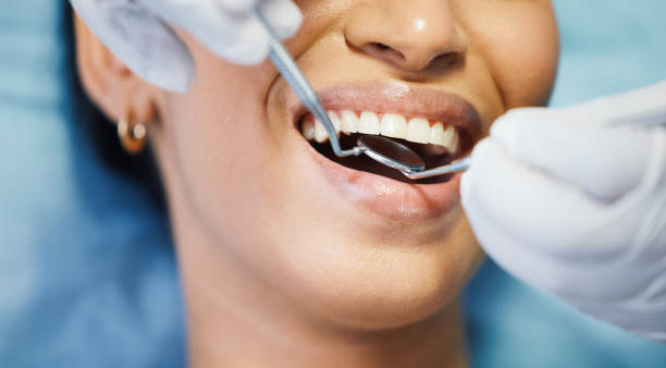 Best Emergency Wisdom Teeth Removal in Reidville, SC