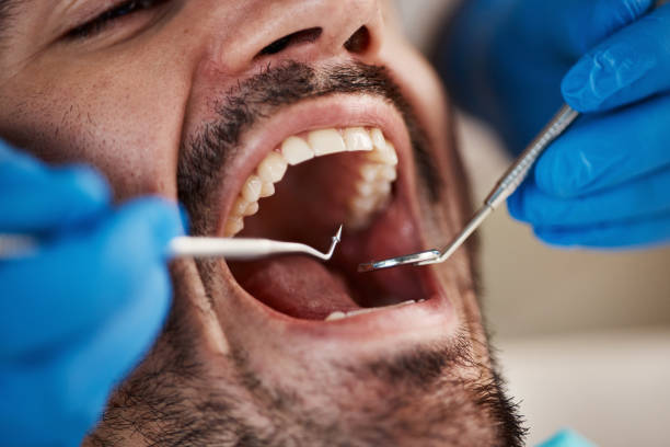 Best Walk-In Emergency Dentist in Reidville, SC